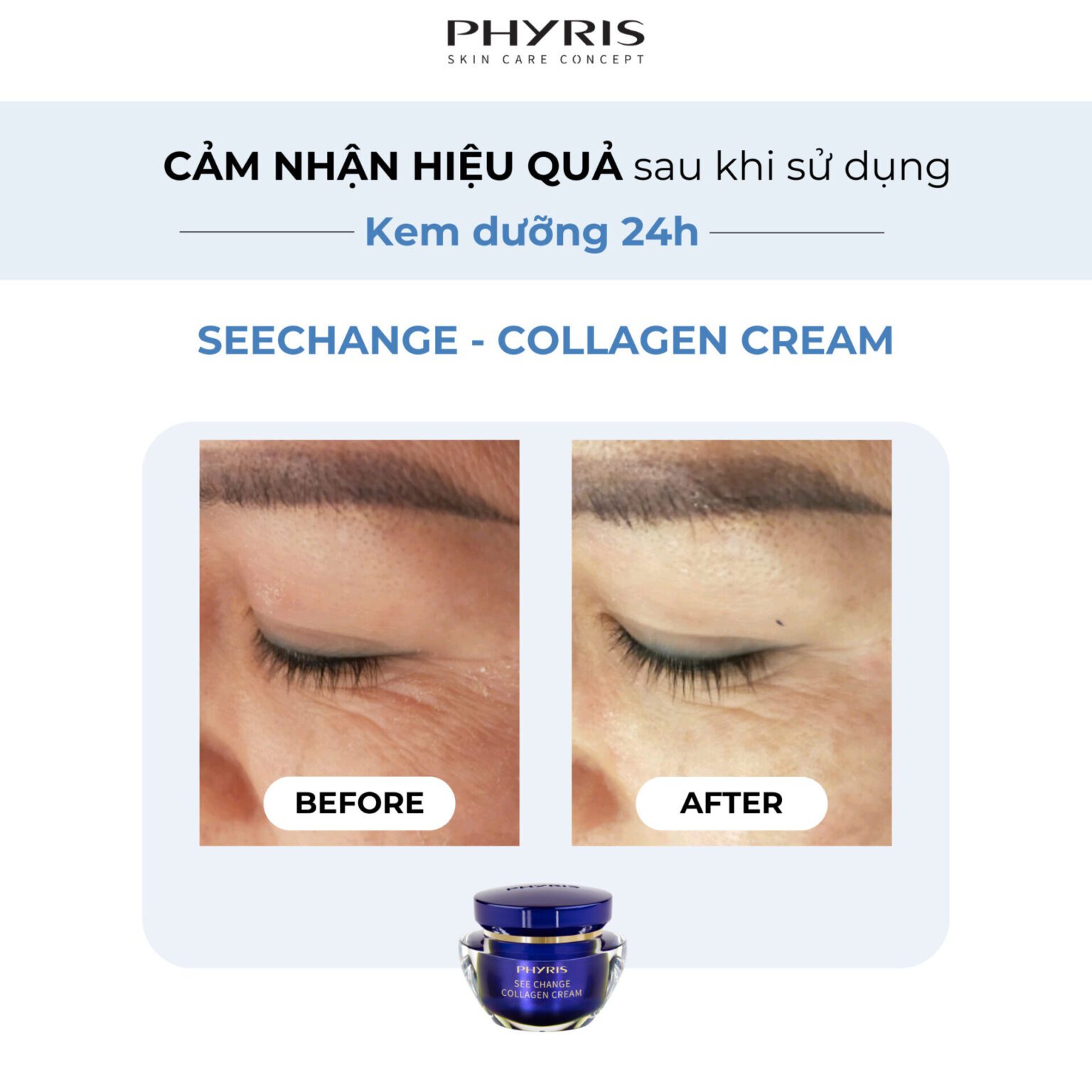 Lý do nên chọn kem dưỡng Phyris SeeChange Collagen Cream